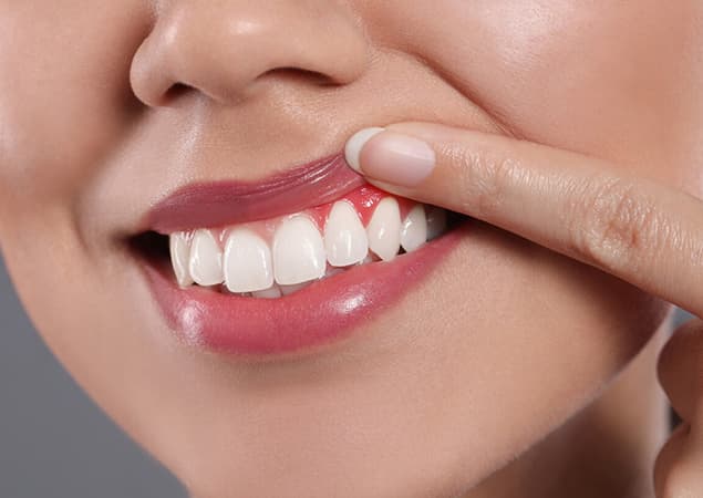 Close-up of a woman lifting her lip to show healthy pink gums and white teeth