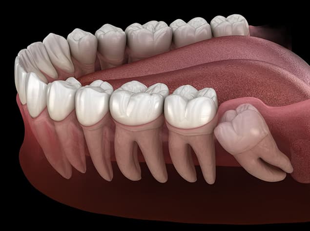 Young adult patient smiling in the dental chair before a wisdom tooth evaluation in Burke, VA