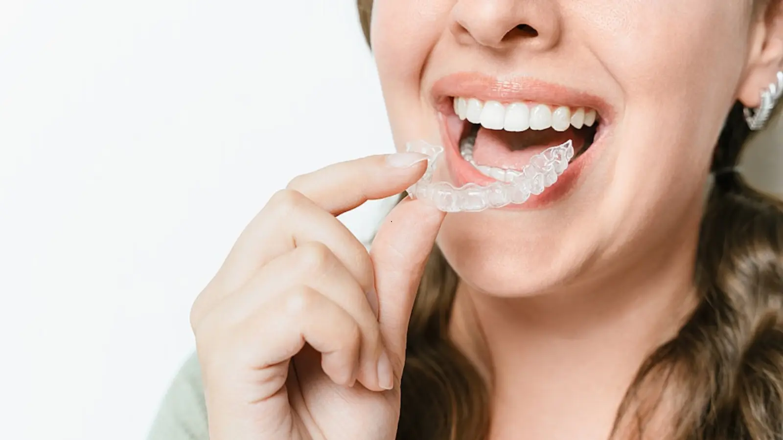 How to Easily Remove Your Clear Aligners