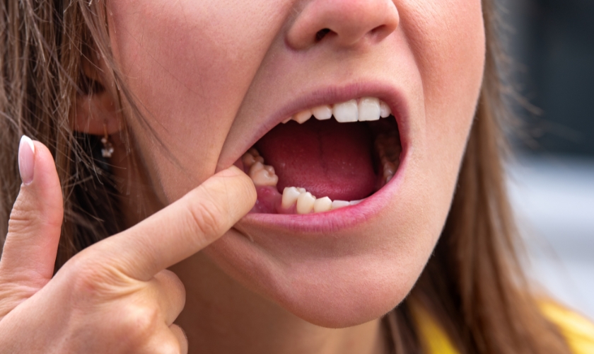 How Dental Implants Restore Missing Teeth