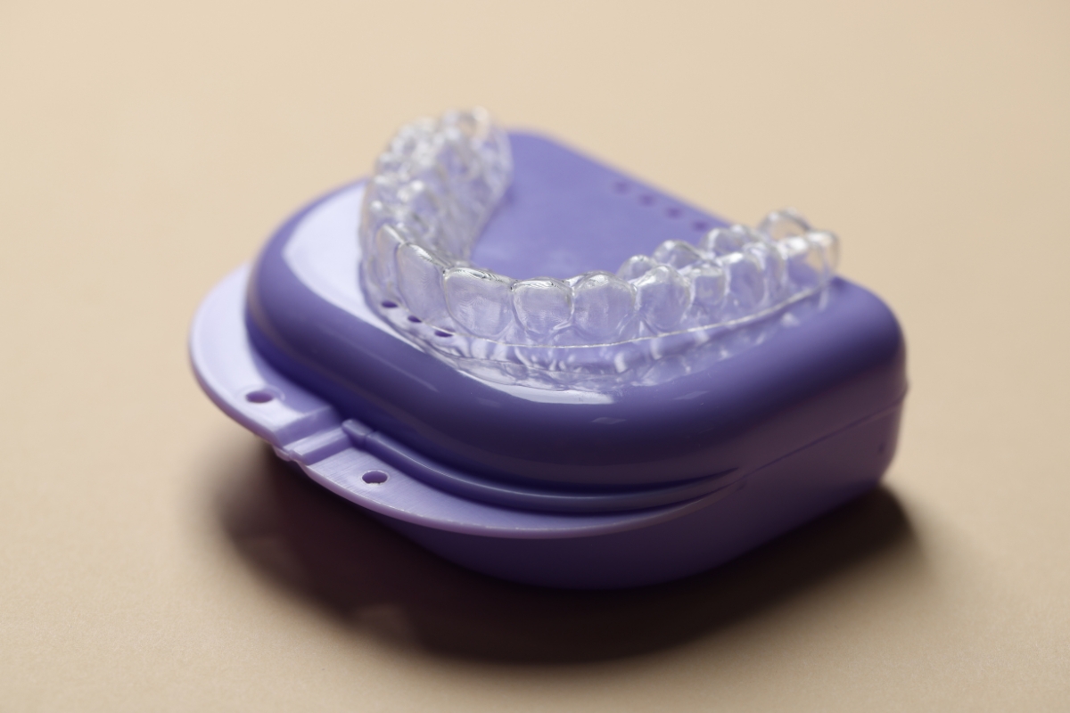 clear-aligners-in-Burke
